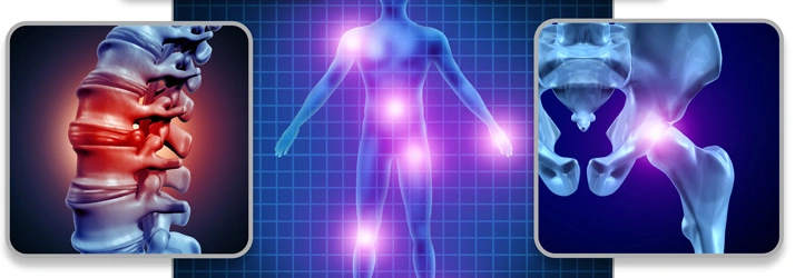 A medical illustration showing a human silhouette with highlighted pain points, flanked by detailed images of the spine and pelvic bones, representing musculoskeletal conditions.
